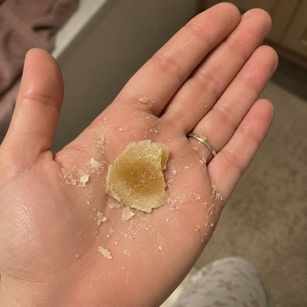 Ma femme n'a plus de corne après 7 ans grâce à ça !