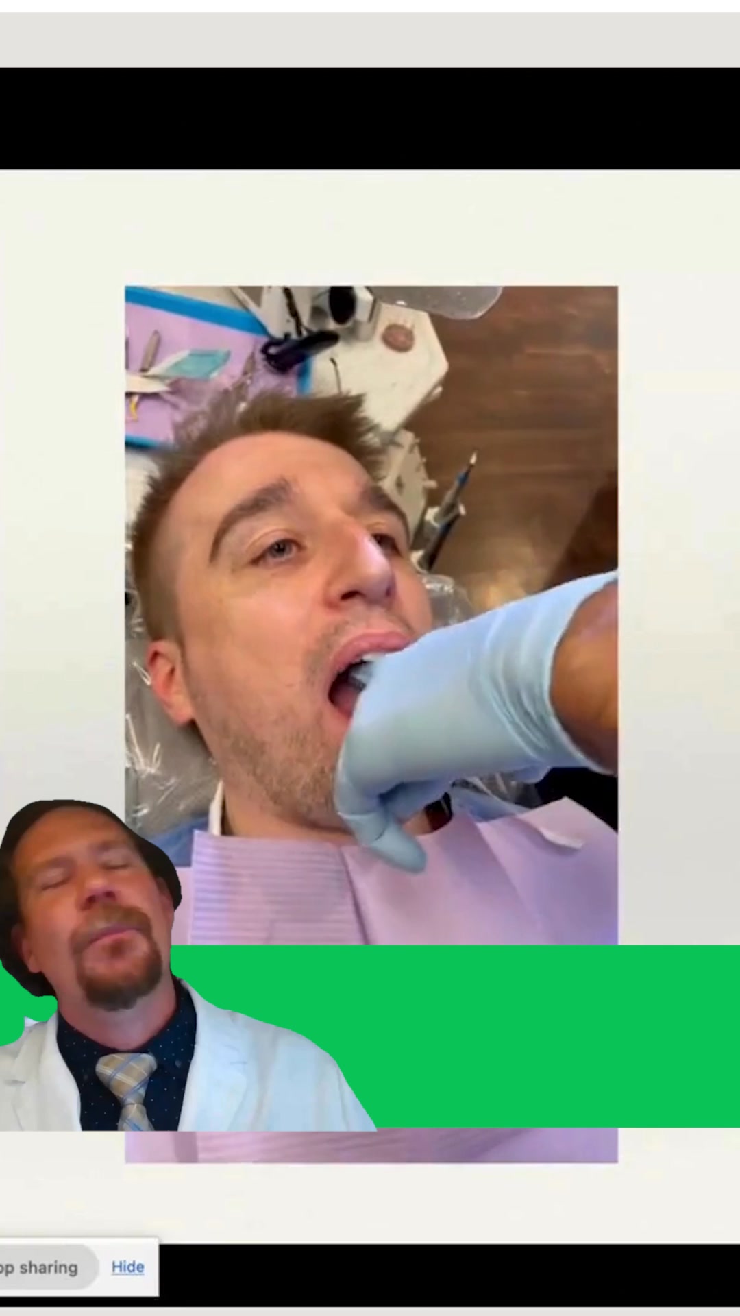 Webinar: 8 Tips for Perfect Dentures