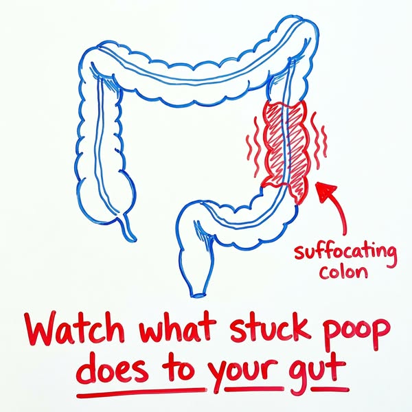 How I dissolved years of cemented poop after my colon suffocating itself to death