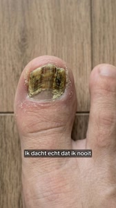 De precieze reden waarom Gezondheidsweek besloot Supplend onder de loep te nemen