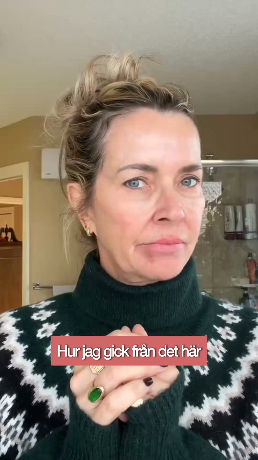 Slätare linjer utan botox