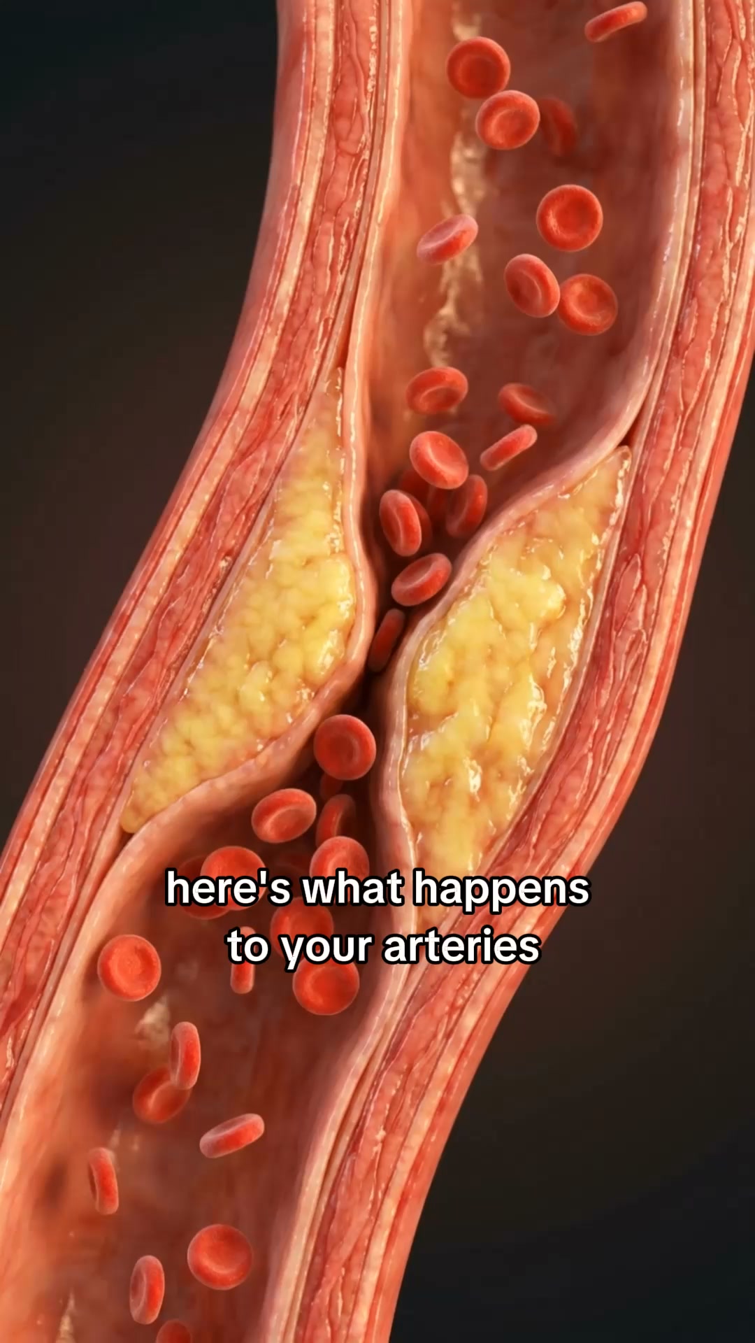 On the same lisinopril your dad was on? Watch what four weeks of clinically dosed beetroot nitrate does to your blood pressure.