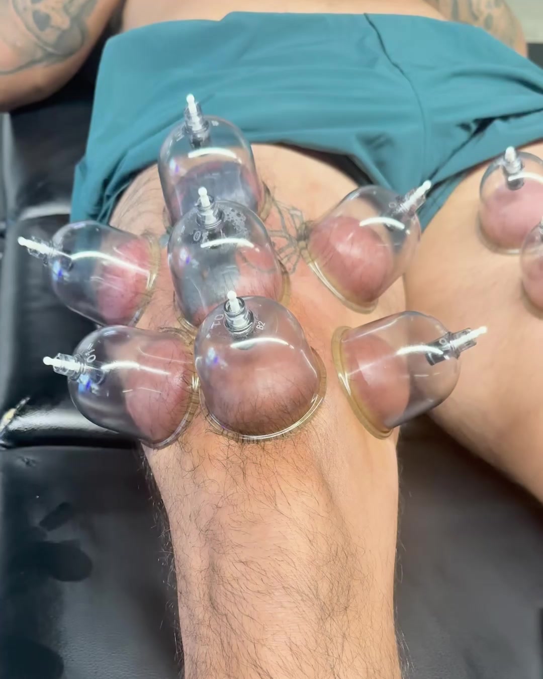 Knieschmerzen oder Arthrose?