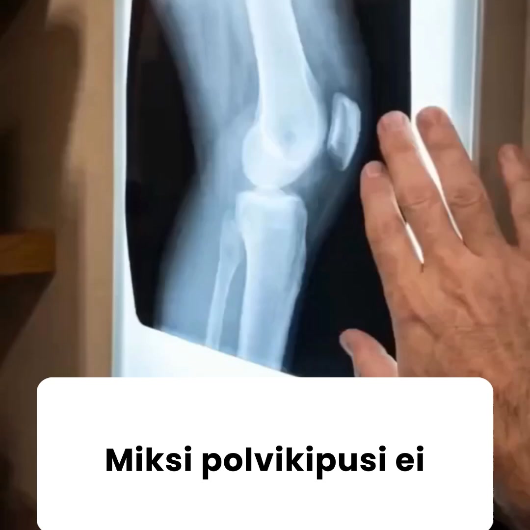 Knee Brace Air: Kohdennettua tukea juuri sinne, missä polvi pettää