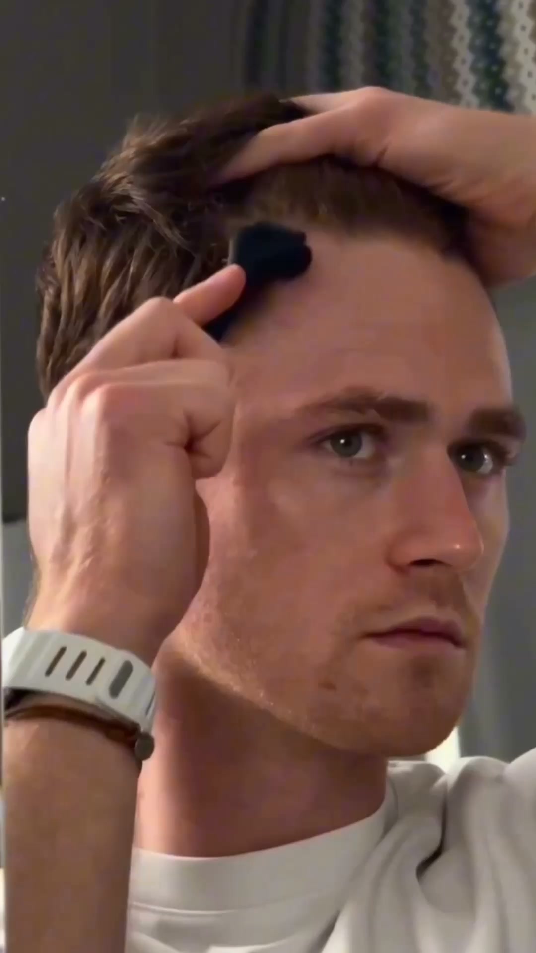 Your hairline. Your call.