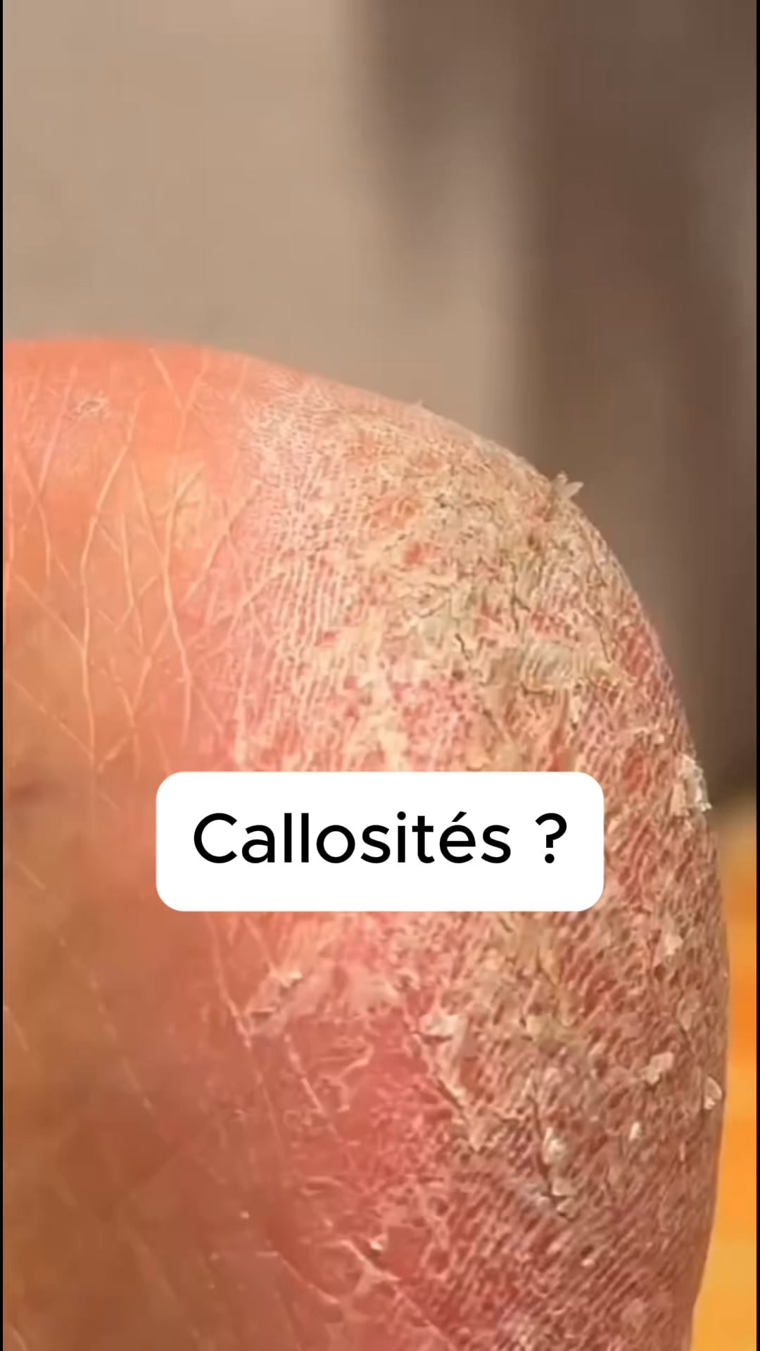 Résultats visibles en 5 minutes