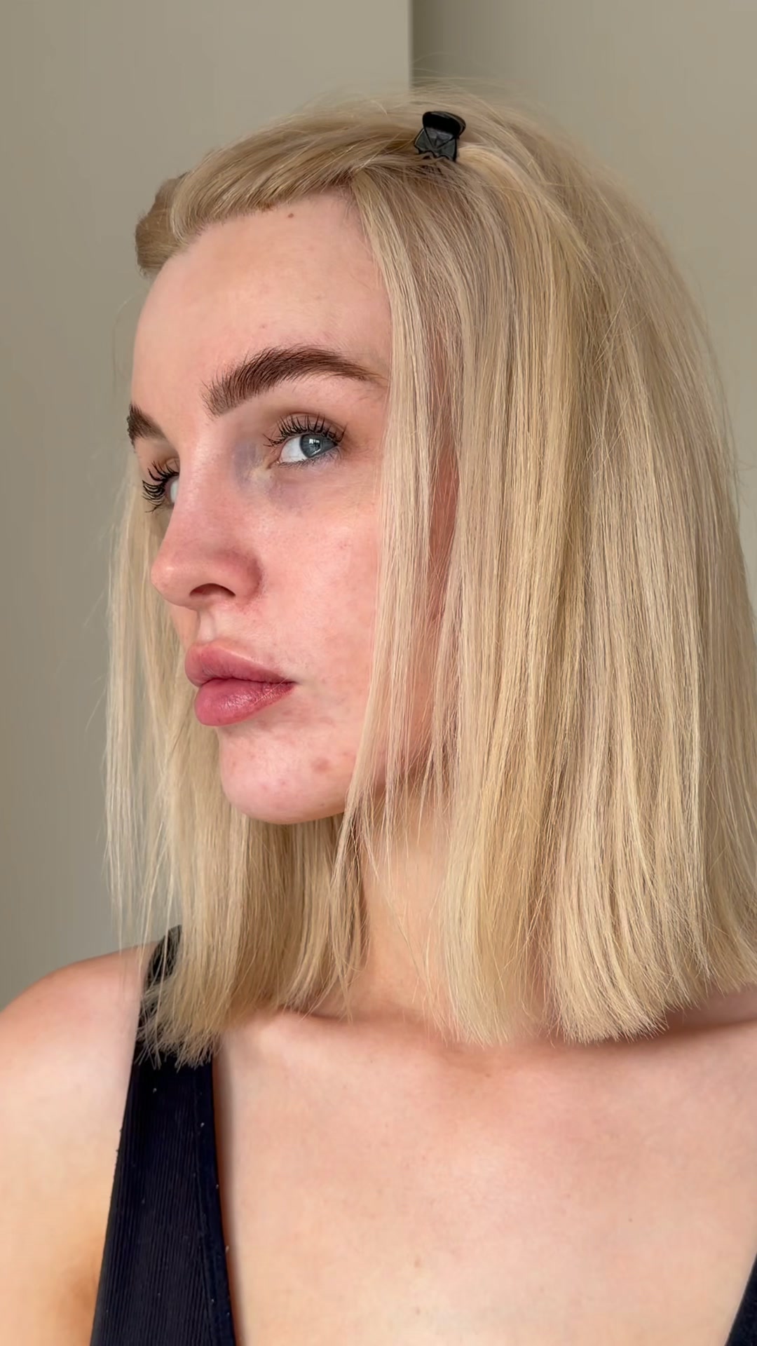 Your skin might just be dehydrated…