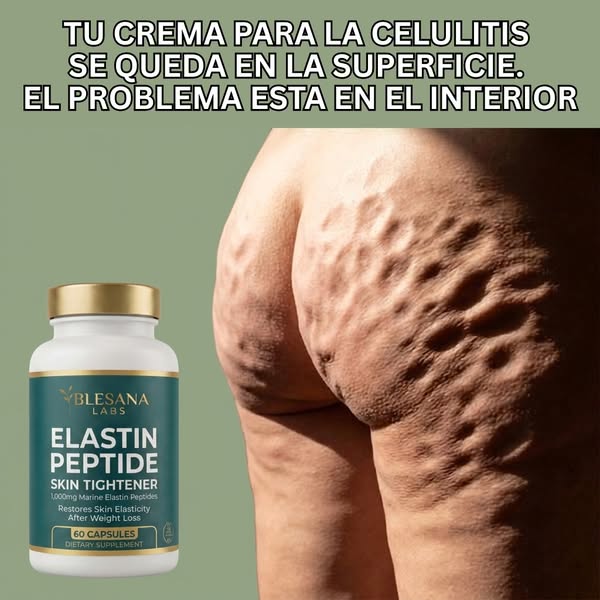 La celulitis no es grasa. Es una proteína que falta