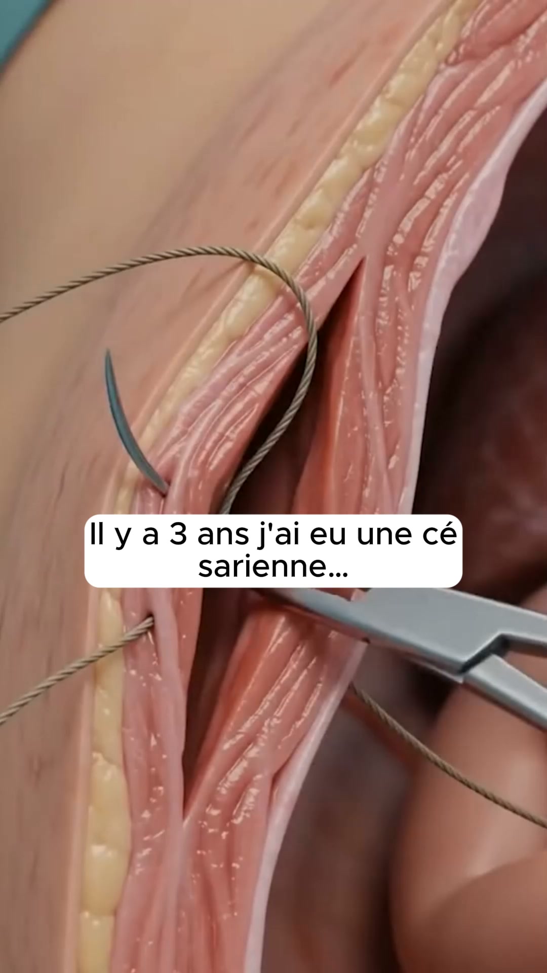 Ventre plus plat dès le premier jour
