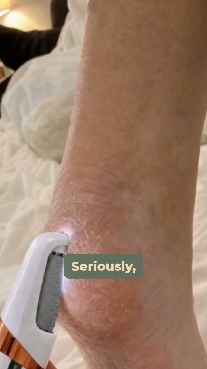 Smoother heels in about 5 minutes