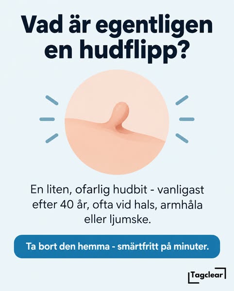 Vad är en hudflik, och hur blir du av med den?