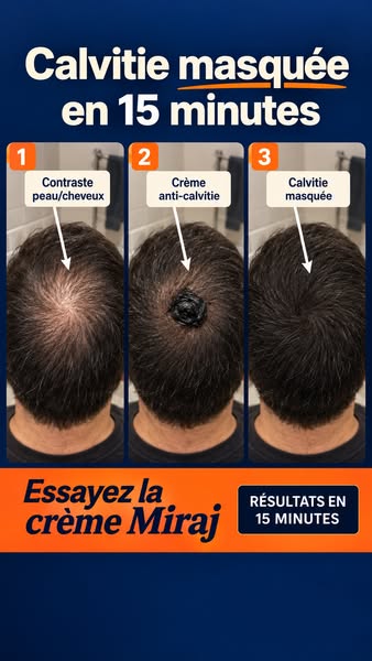 Crème Anti-Calvitie