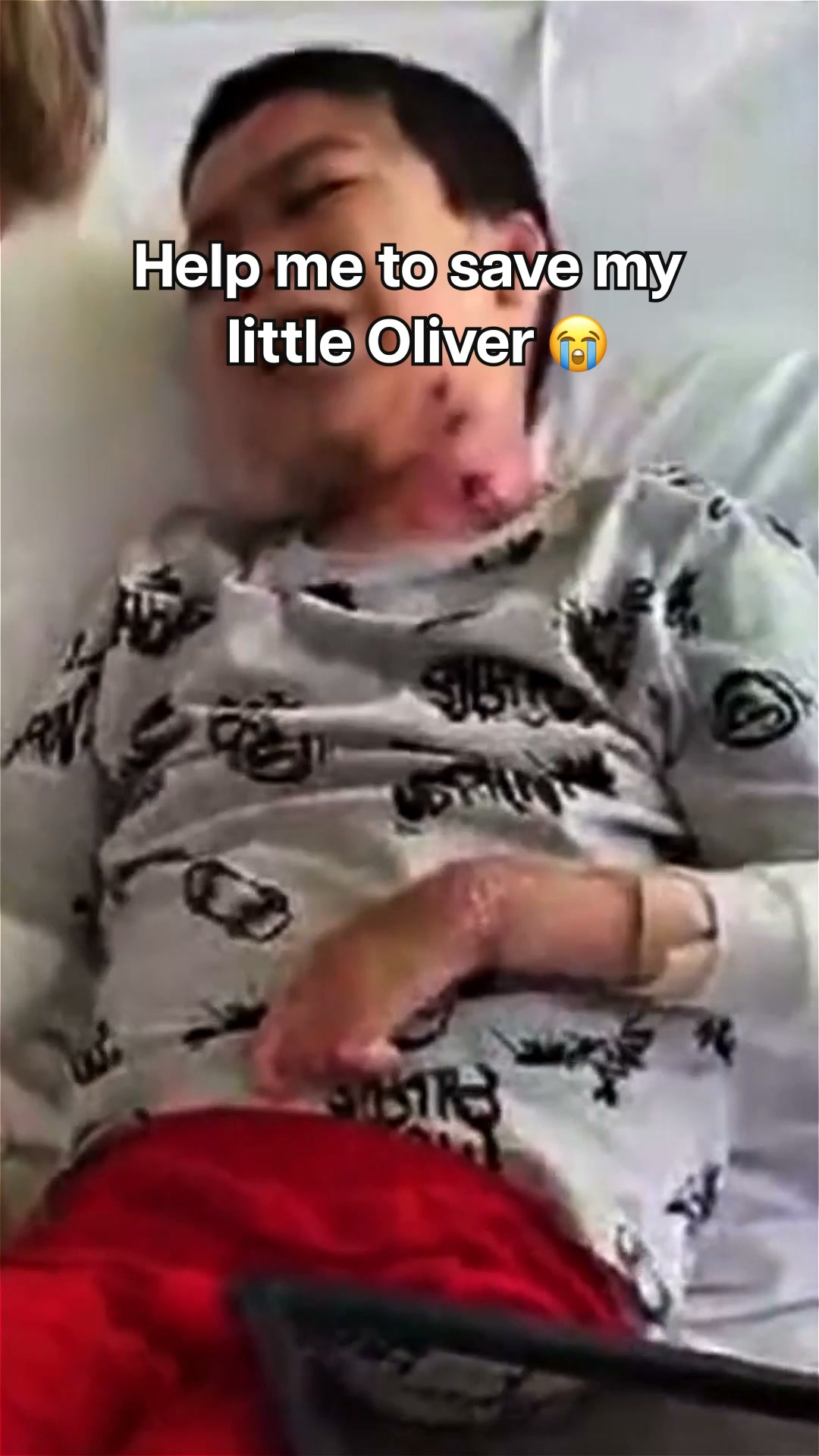Help provide Oliver with medication, wound dressings, nutrition, and ongoing care. Every gift matters.