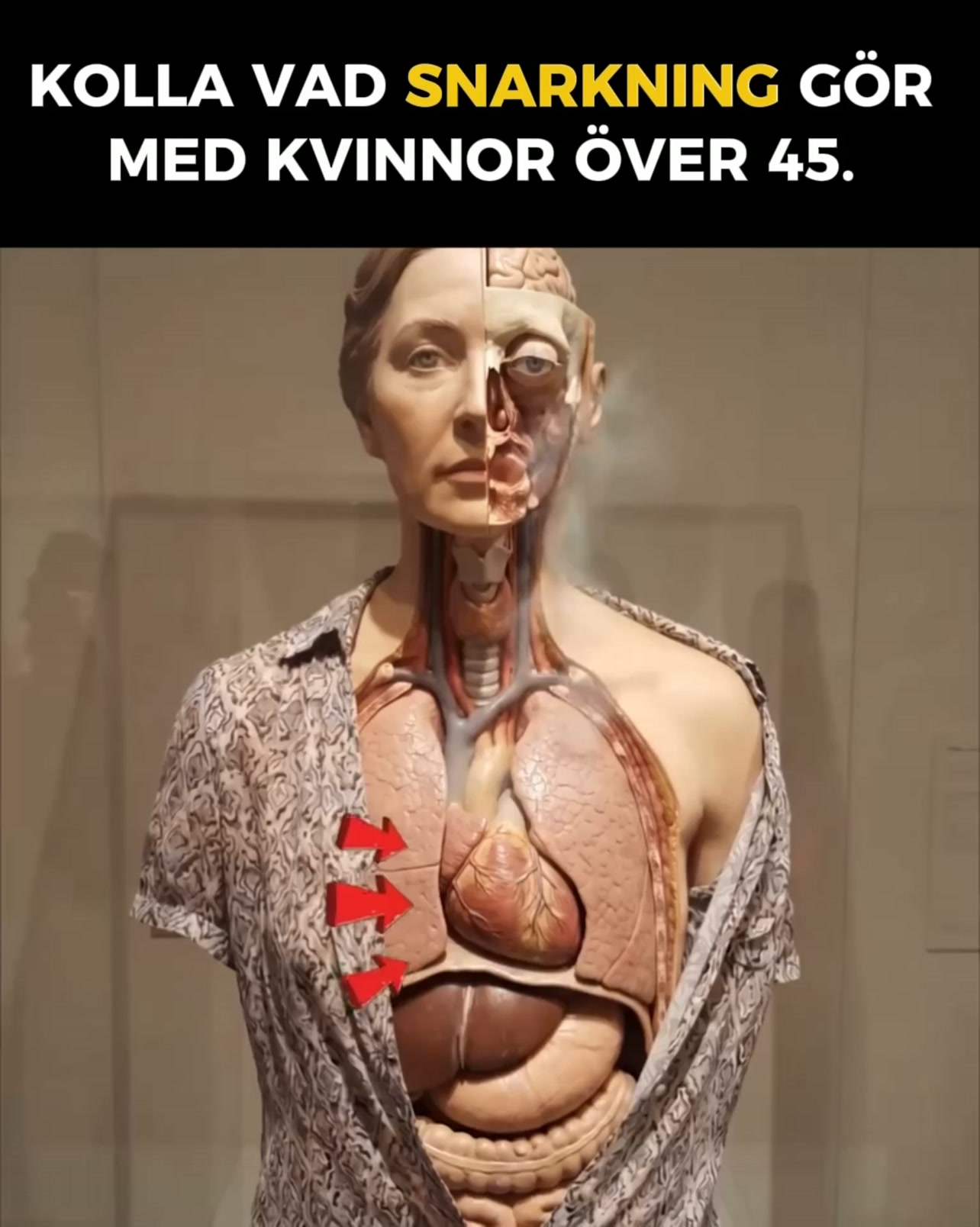 Hur slutar man snarka?
