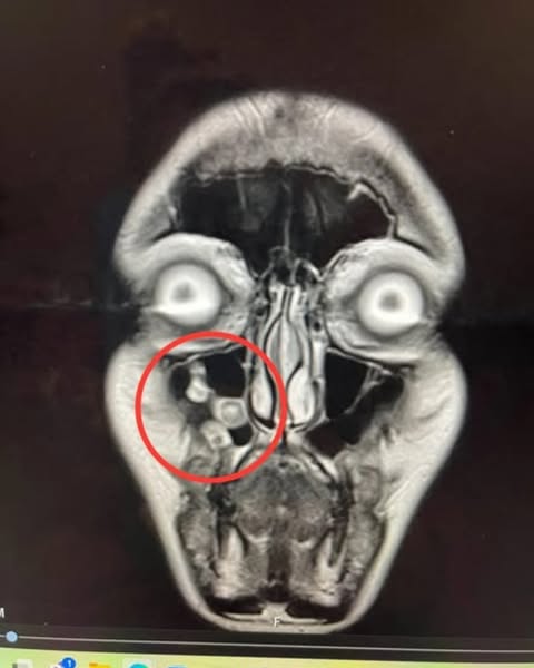 Chronic Sinus Problems? Read This