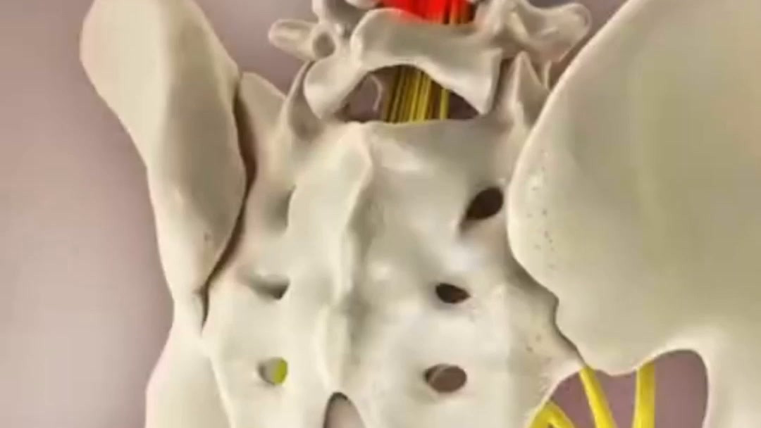 Relieve Sciatica & Lower Back Pain While You Sleep