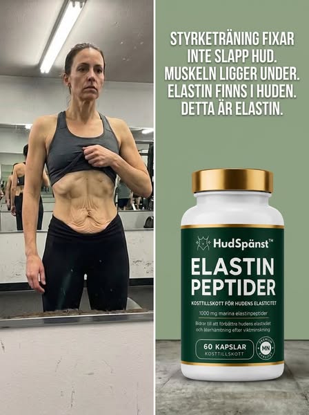 Slapp Hud? Det Är Inte Vikten. Det Är Elastinet