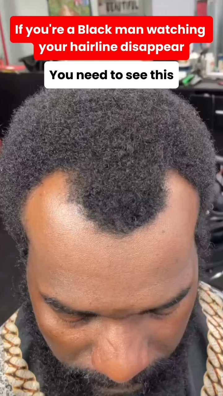 Natural hair growth