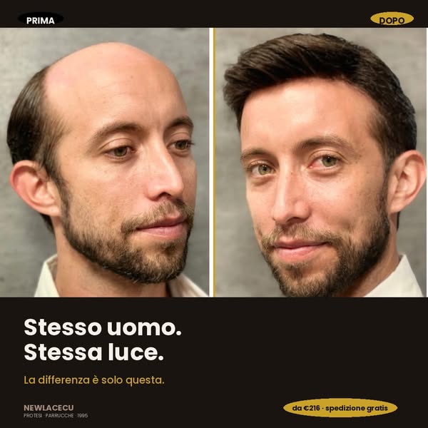 La differenza si vede. La protesi no.