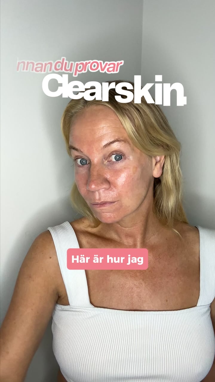 Återfå din ungdomliga skönhet