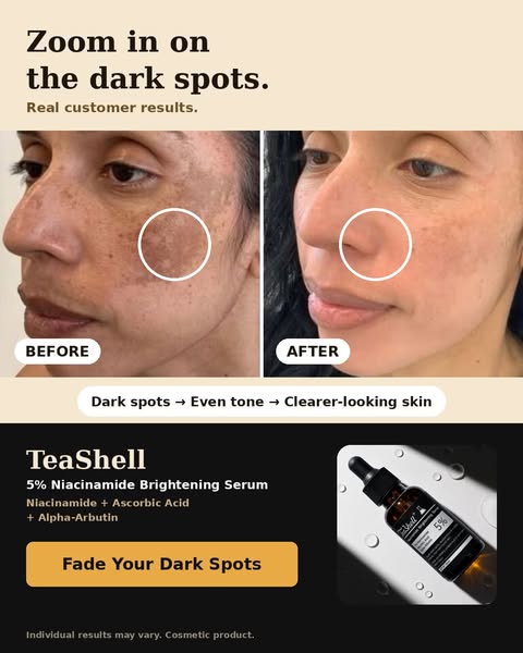 Finally-Skin You're Proud to Show
