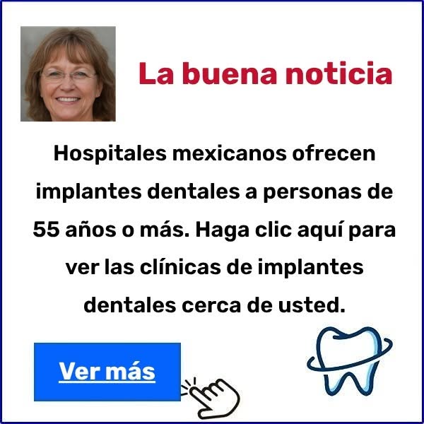 Implantes dentales
