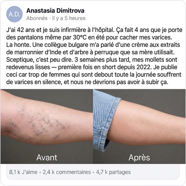 Vos veines méritent mieux que des jambes lourdes.