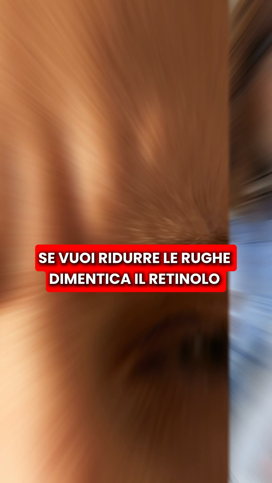 Scopri il kit micro-infusione di Renovae