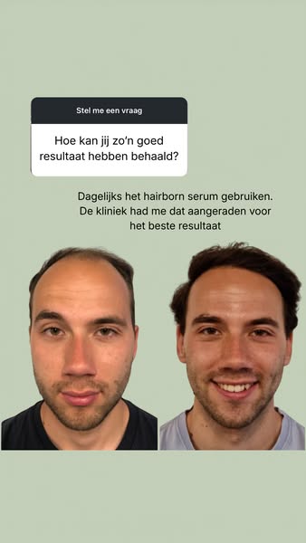 Officieel partner van haartransplantatieklinieken
