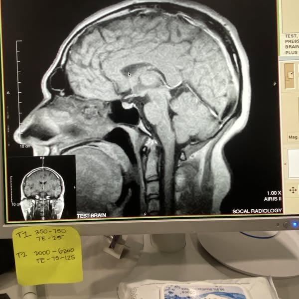 What they don't tell you about MS.