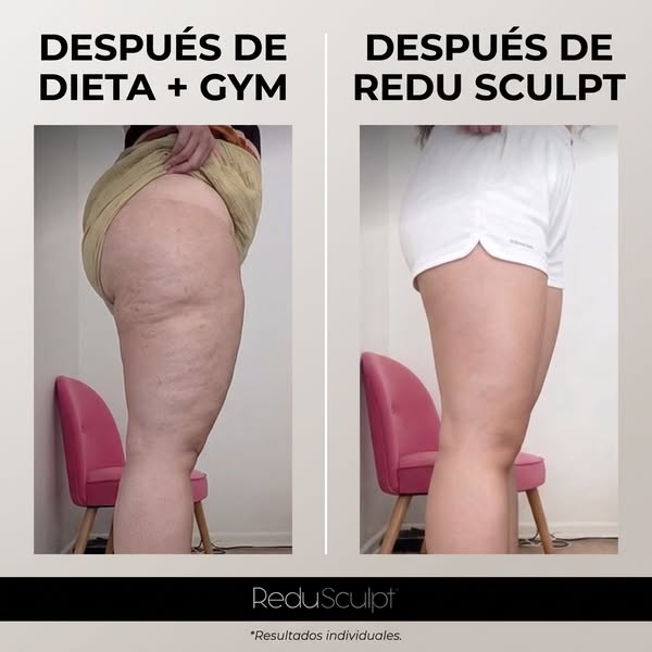 Lo que la dieta y el gimnasio hacen con tu celulitis.