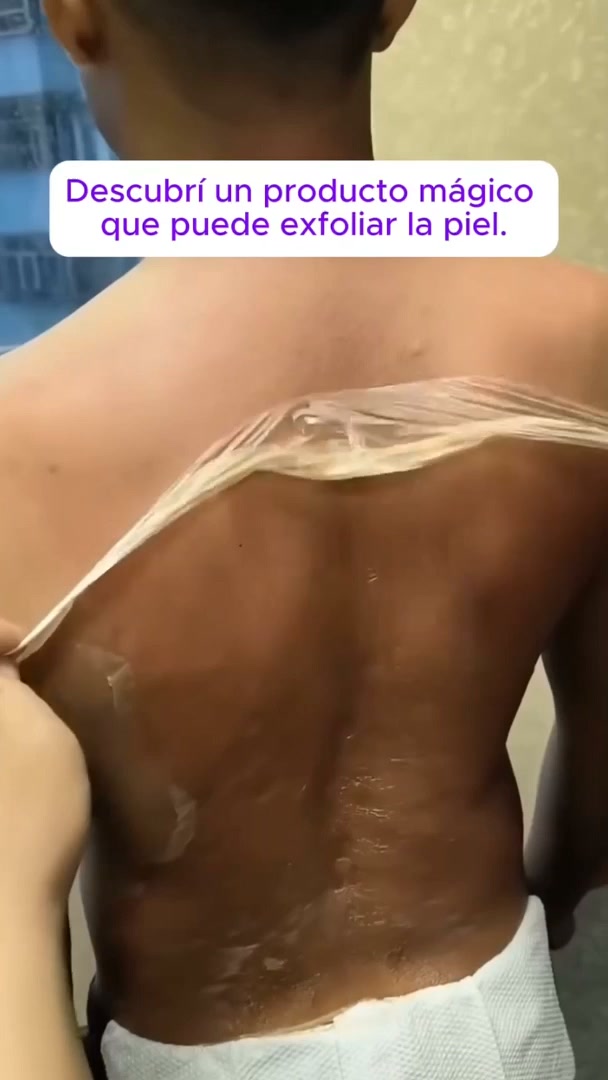 A Different Peeling Oil