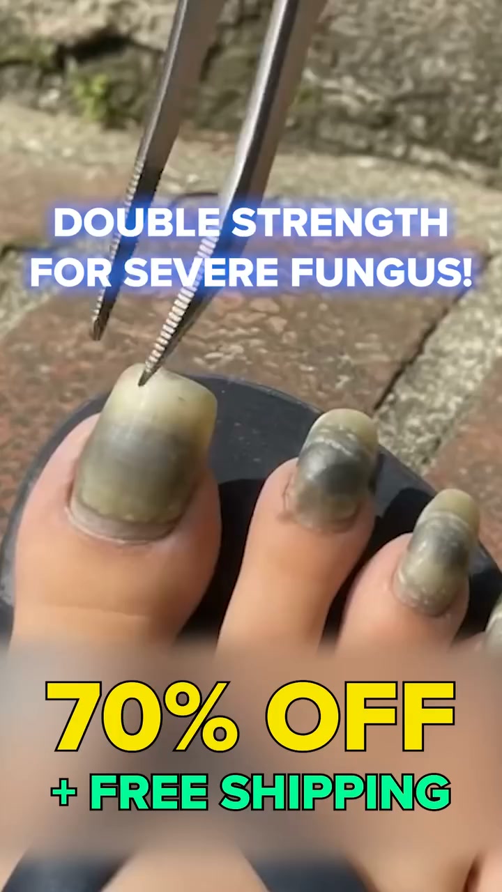 The Fastest Way To Get Rid Of Nail Fungus