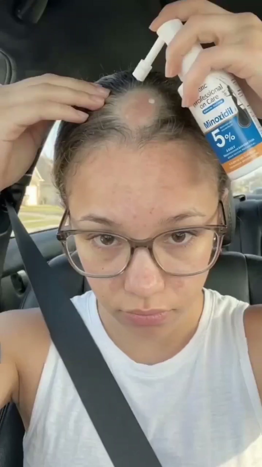 Capelli Più Folti Dalla Radice