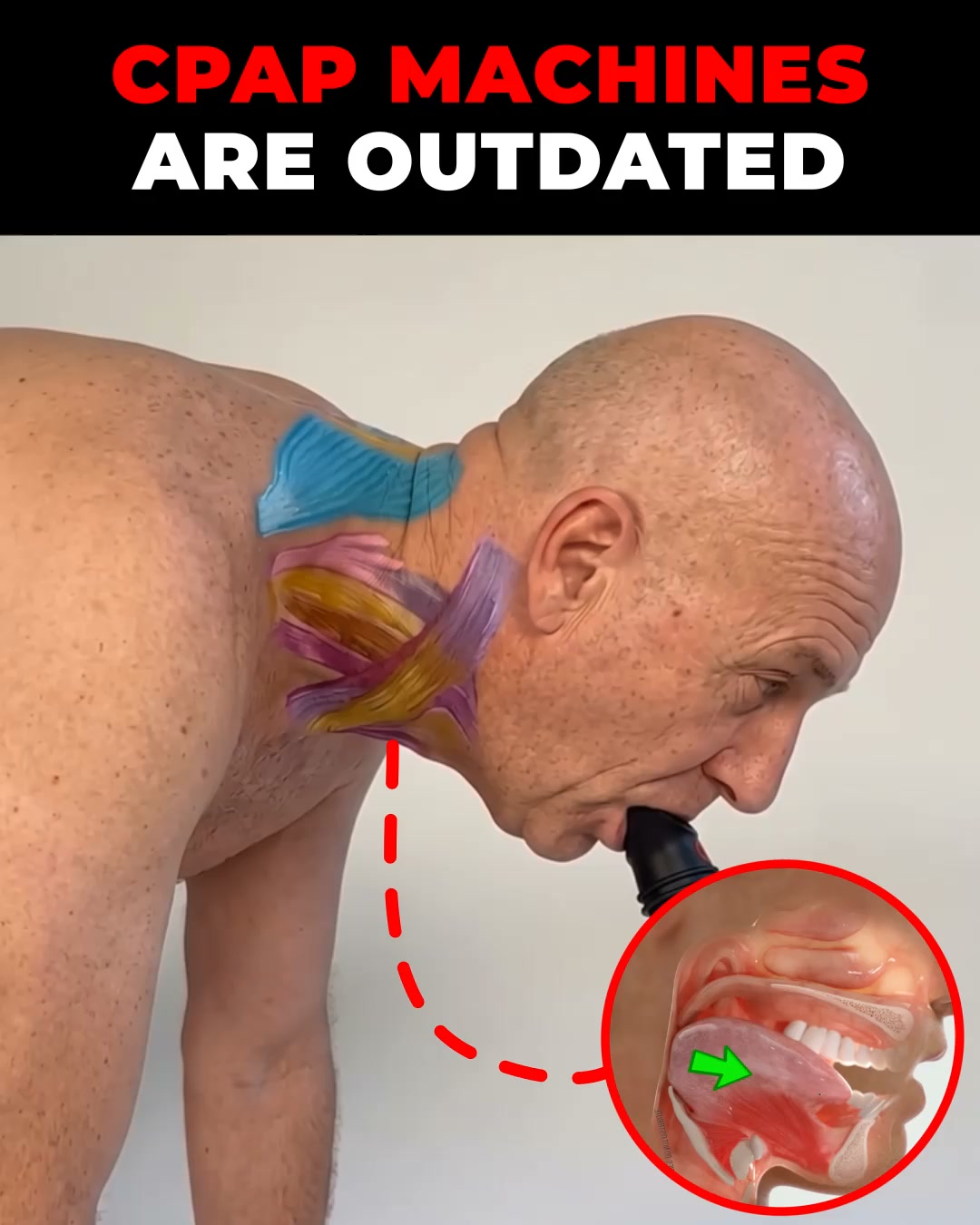Fix Snoring & Sleepless Nights