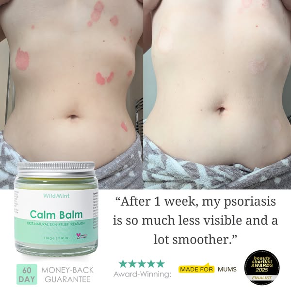 End the Struggle of Sore Skin for Good!