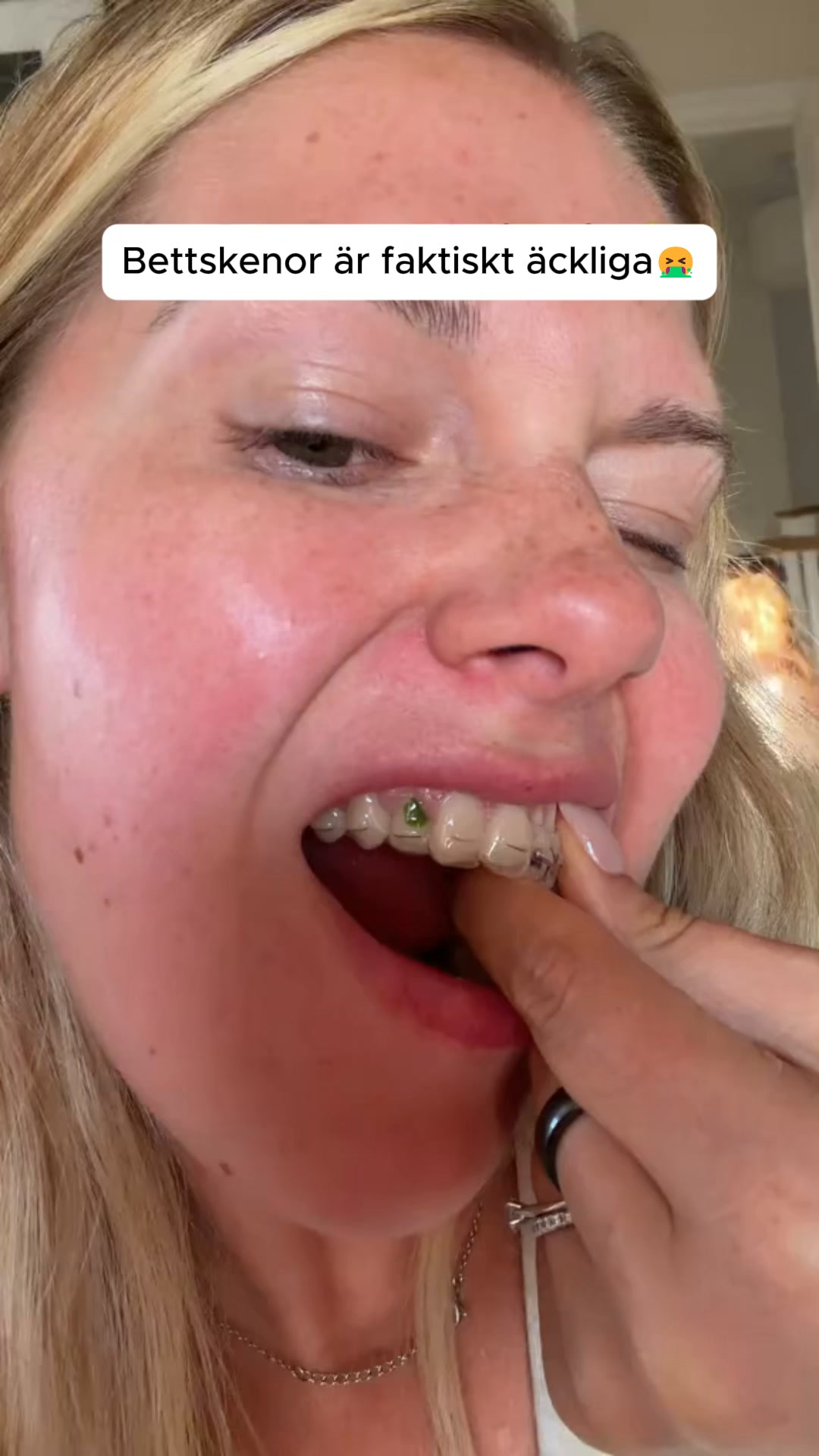 Sluta förvara din skena ohygieniskt – Upptäck OralDock™