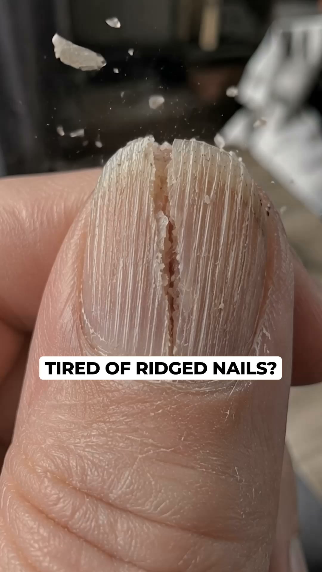 Why Nails Get Ridges After 50