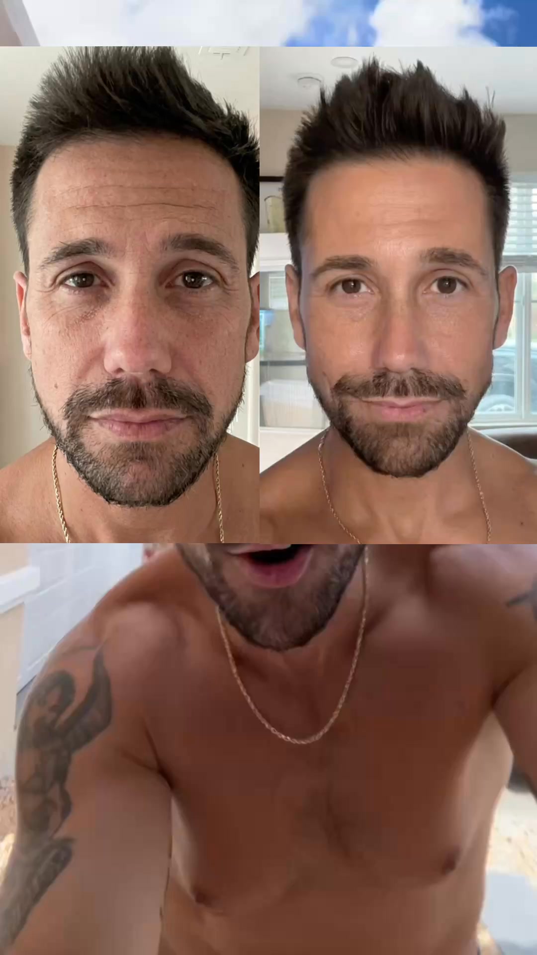 No Botox. Just this.