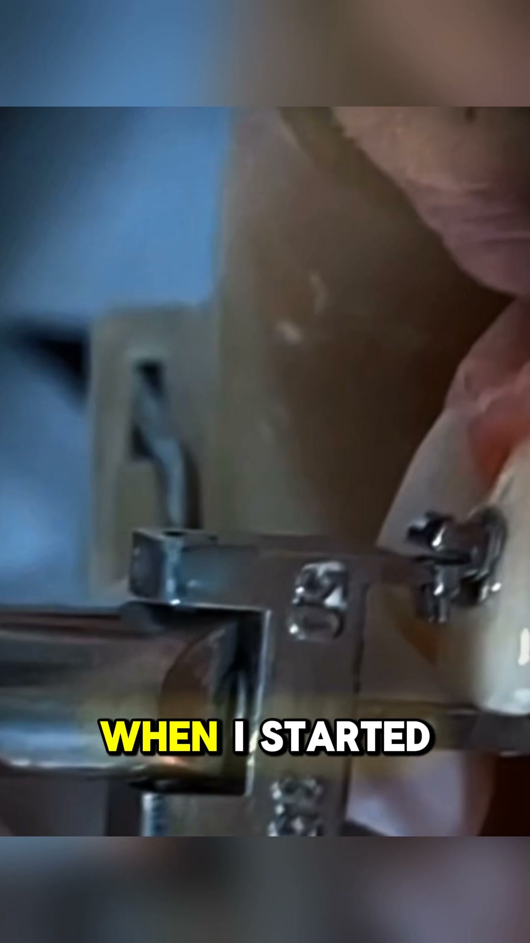 The mistake isn’t in the technique.
It’s in the decision.