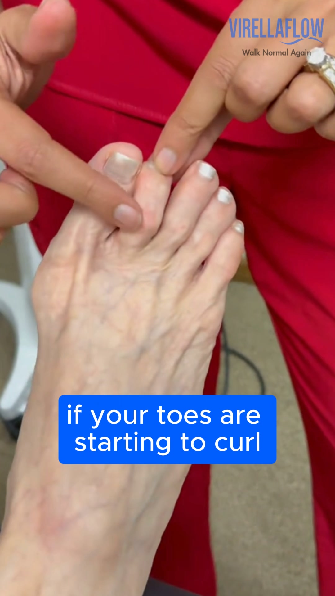 BEST FIX FOR HAMMETOES