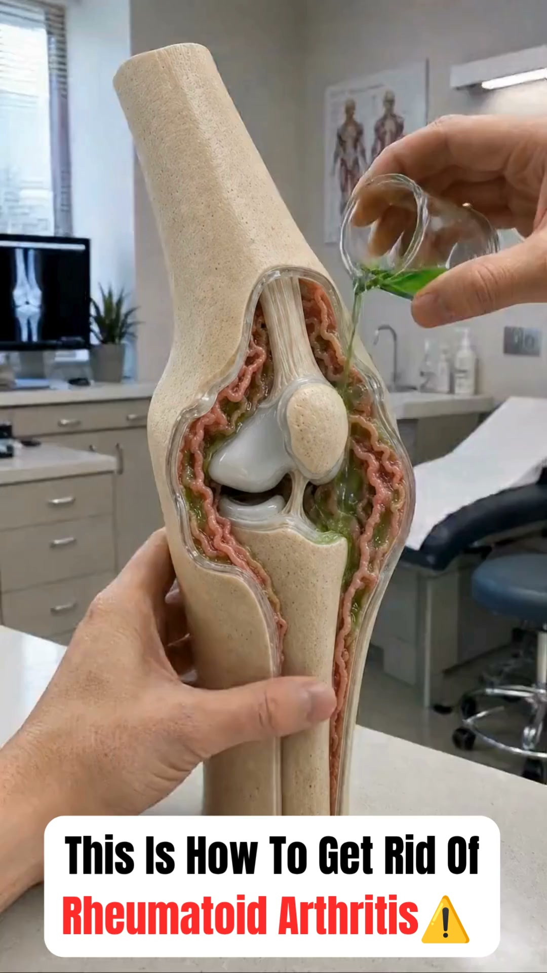 The truth about rheumatoid arthritis