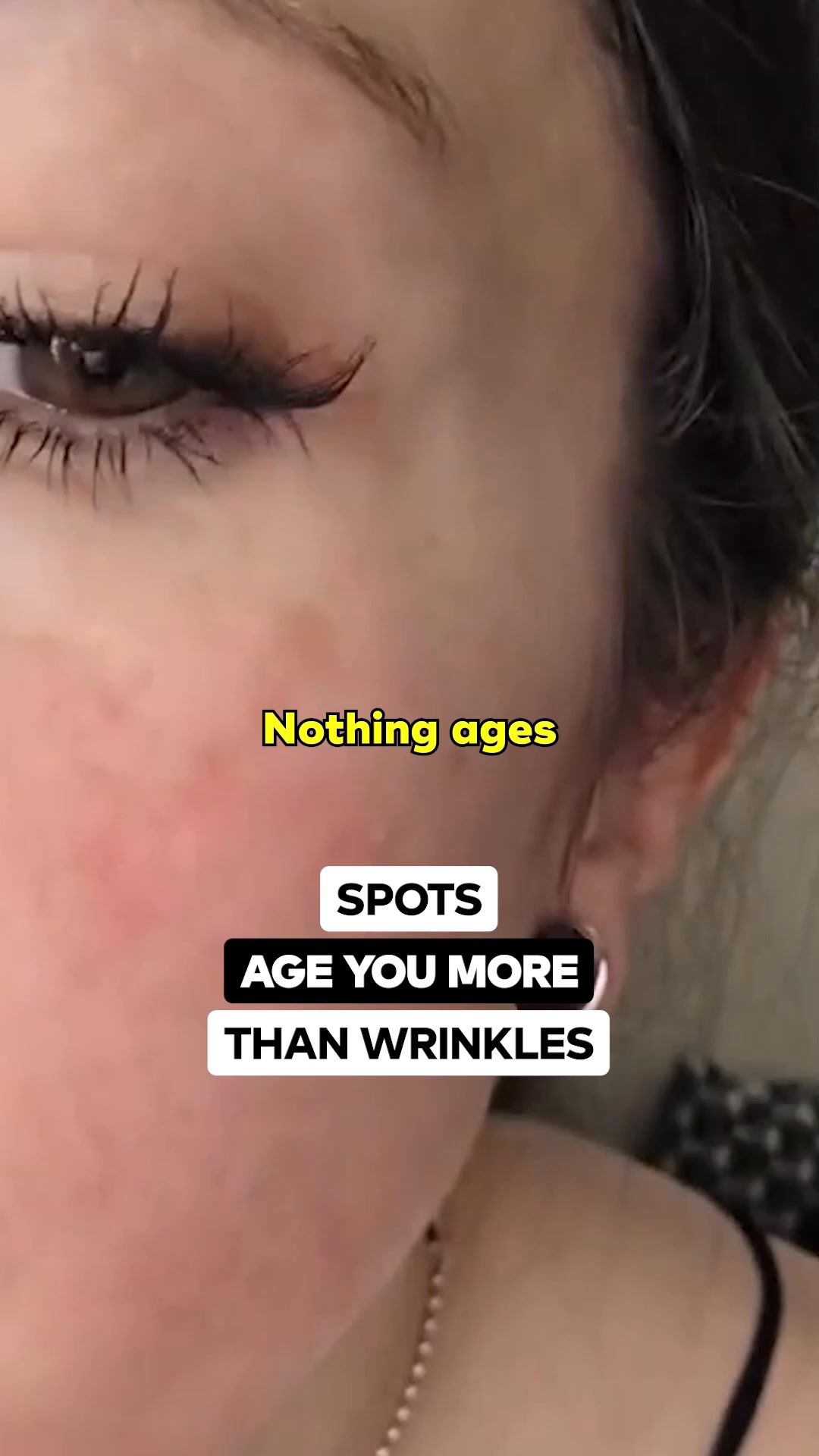 The Dark Spot Myth: The Real Reason Spots Keep Coming Back
