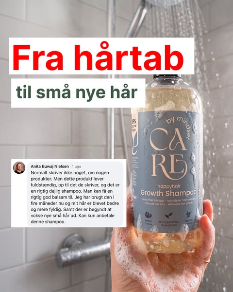 Farvel hårtab — goddag nyt hår