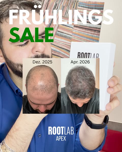 Volles Haar in 3-5 Wochen oder Geld zurück.