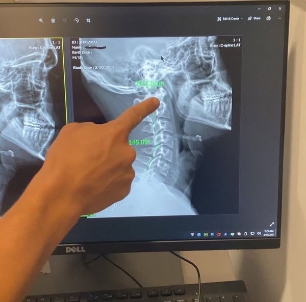 VERTIGO ISN’T JUST DIZZINESS
