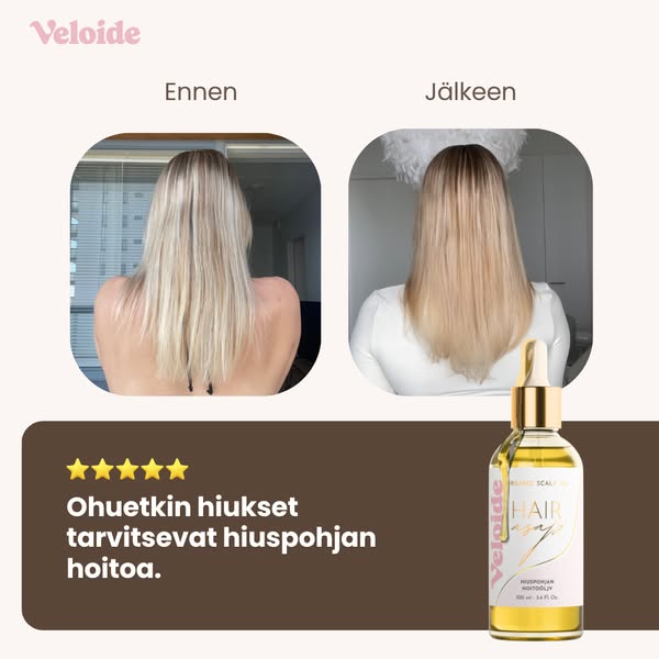 Ohuetkin hiukset tarvitsevat hiuspohjan hoitoa.