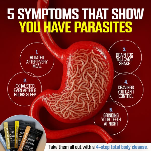 A structured parasite support routine