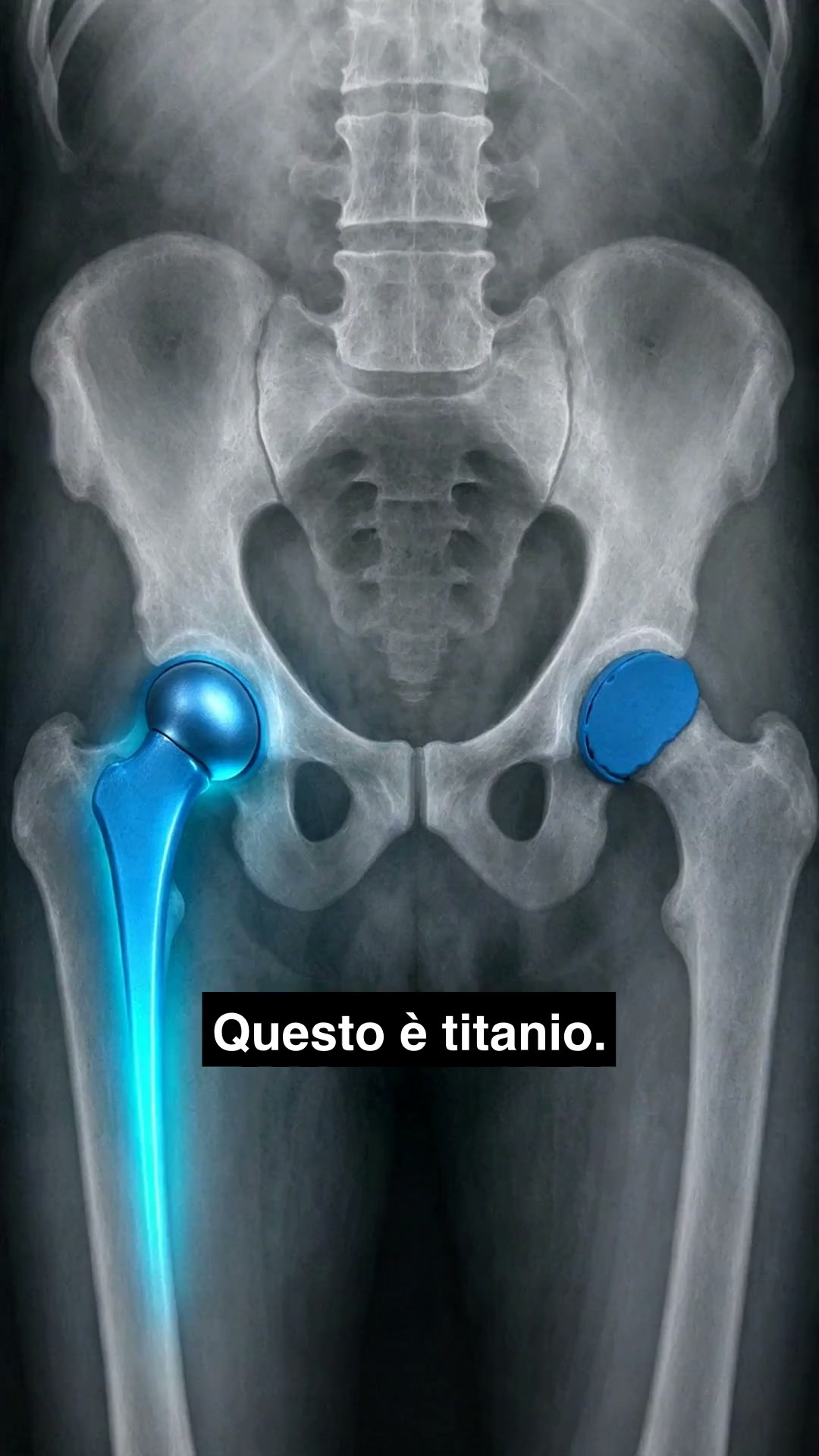 50% oggi + spedizione gratuita