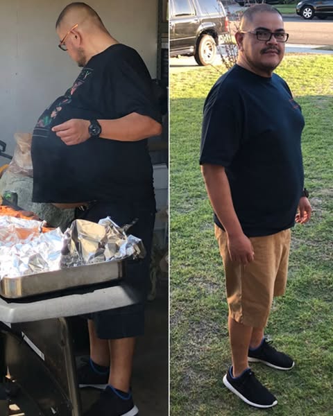 That's Not A ‘Beer Belly’. That's Liver FailureRead This If You Have a 'Beer Belly'Get Rid Of The 'Beer Belly' For Good